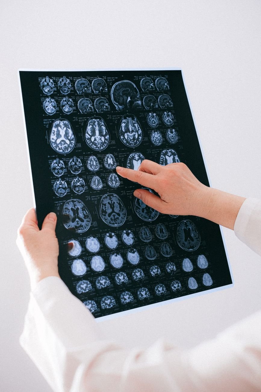 BREAKING MEDICAL NEWS: THE EUROPEAN NEUROLOGY ALLIANCE ...