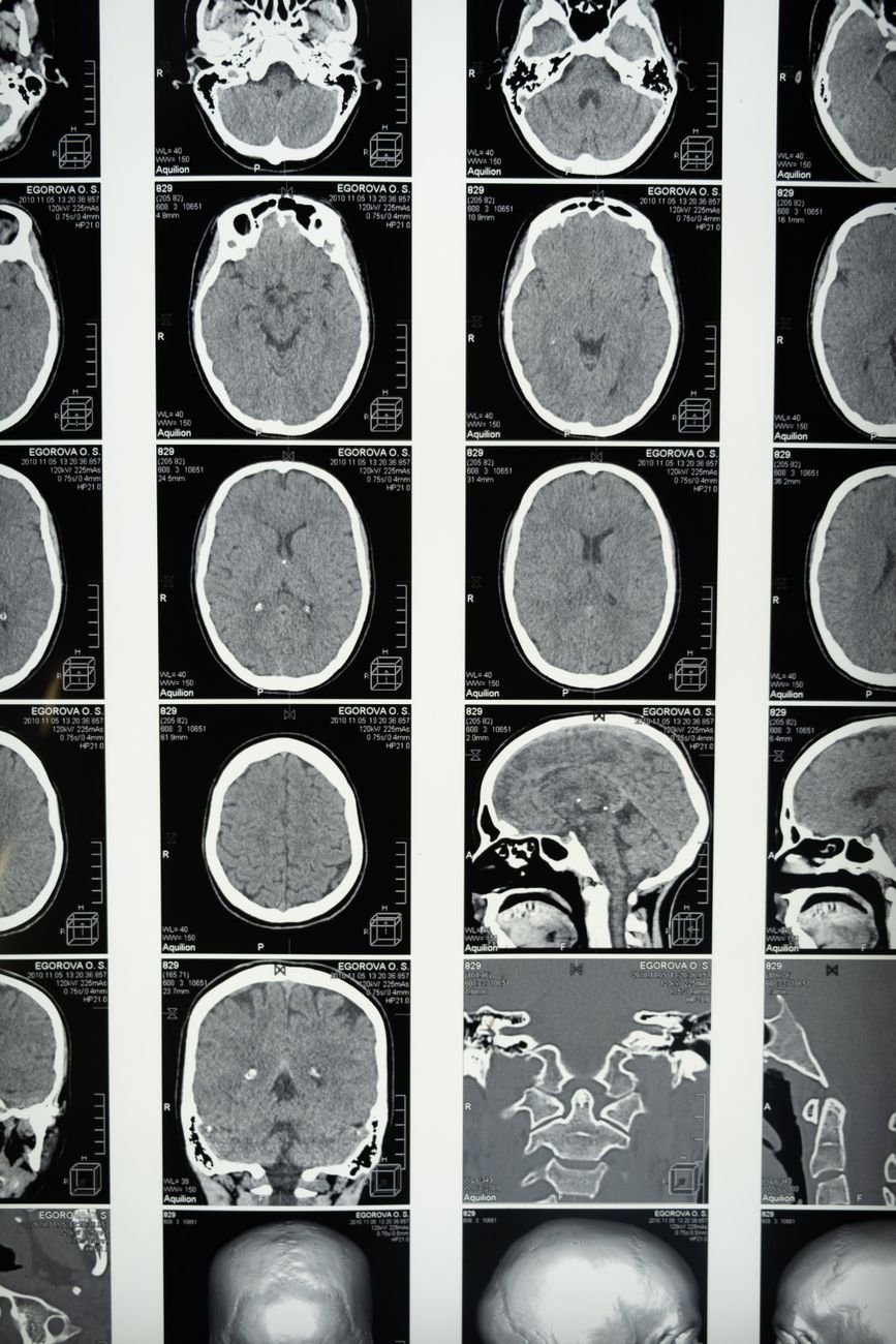 European Neuro-Alliance Releases Urgent Cognitive Alert...